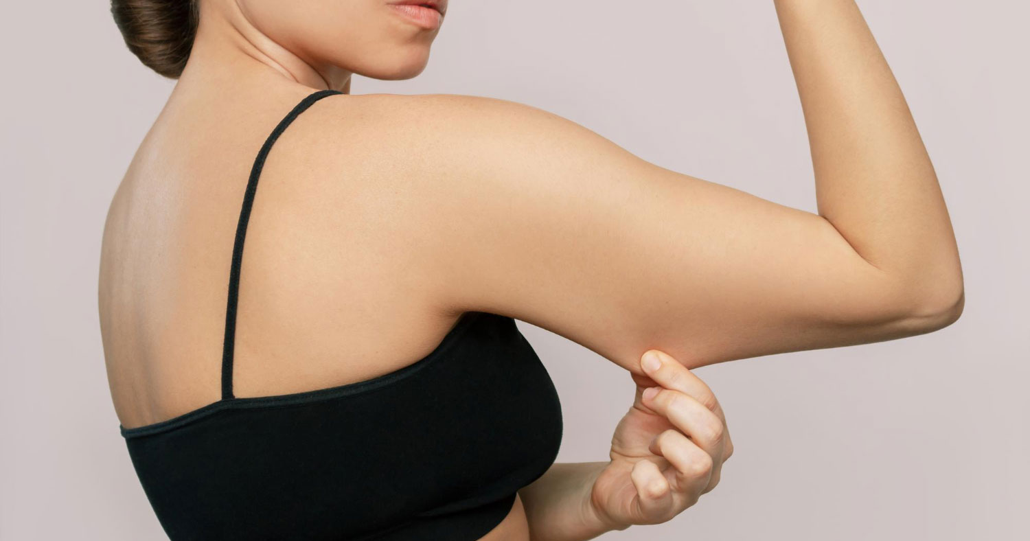 Armpit fat underarm wrinkled skin, Saggy skin removal. woman body