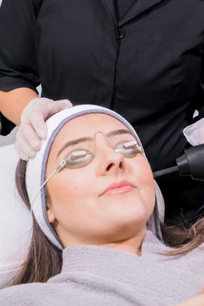 Fractional Laser Treatment Thessaloniki