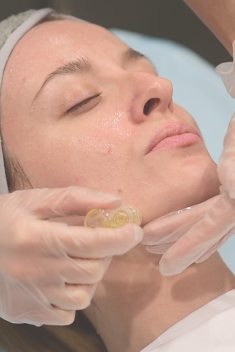 Μεσοθεραπεία hydra needle micro-infusion Θεσσαλονίκη