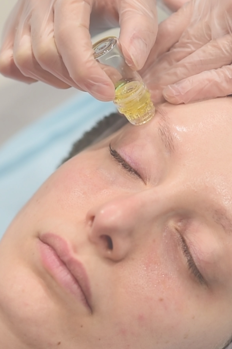 Θεραπεία Ματιών Global Eyecon της Mesoestetic Θεσσαλονίκη