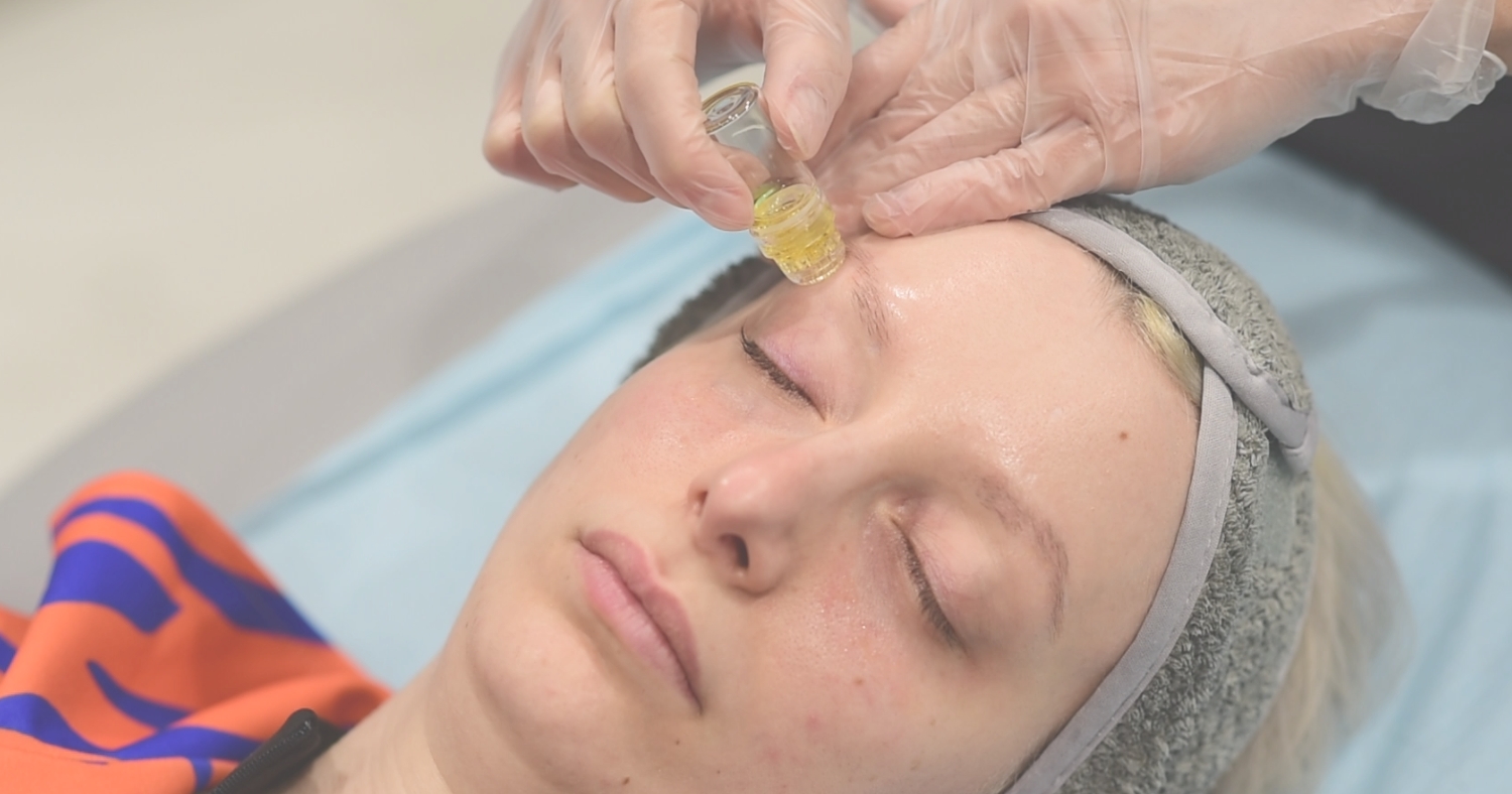 Θεραπεία Ματιών Global Eyecon της Mesoestetic Θεσσαλονίκη