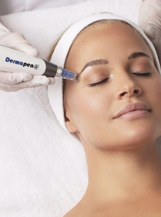dermapen 4