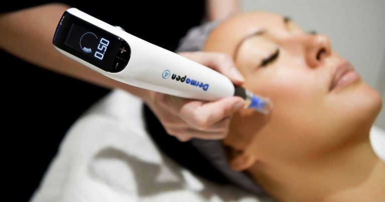 Dermapen Microneedling