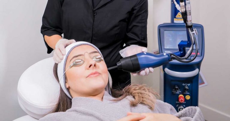 Fractional Laser Treatment