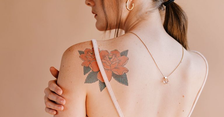 Laser Tattoo Removal with PicoPlus