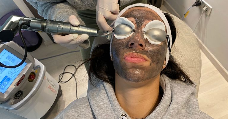 Hollywood Peel με laser Spectra Lutronic