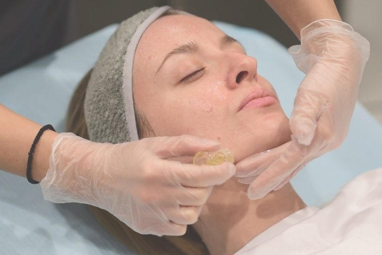 Μεσοθεραπεία hydra needle micro-infusion
