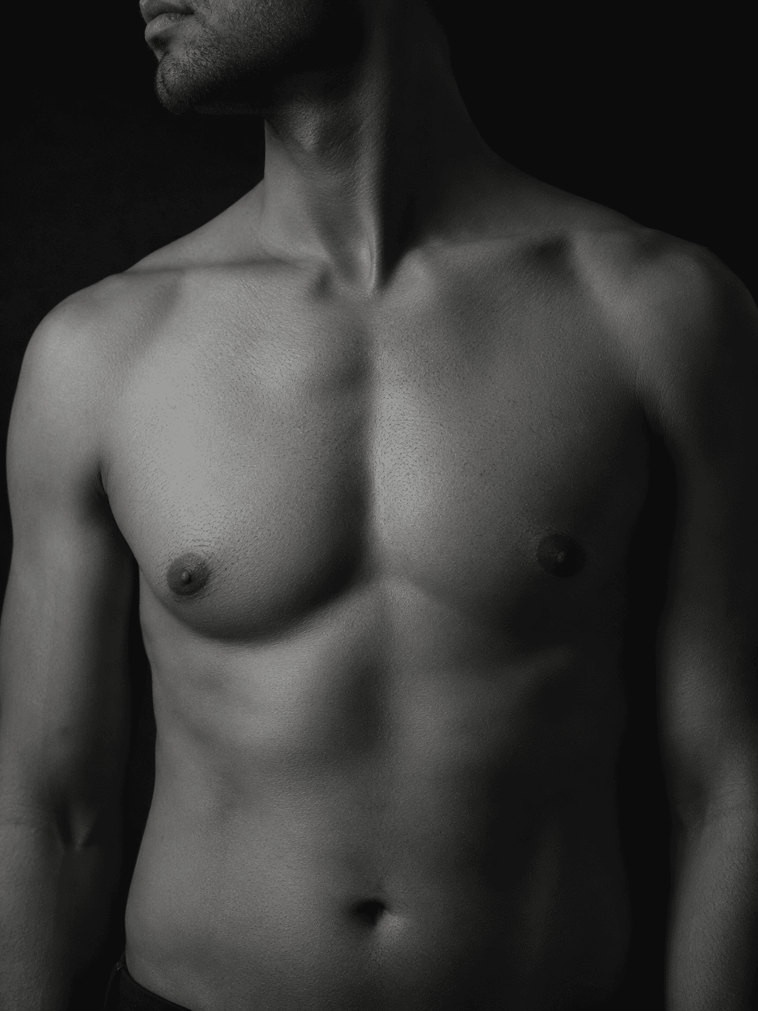 Gynecomastia